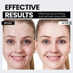 Microcurrent Facial Device,Latest Red Light Technology，Enhances The Ability to Lift The Face and Tighten The Skin，Facial Wrinkle Equipment，Smart Photon Micro-Current Device - Pink - Size 15cm