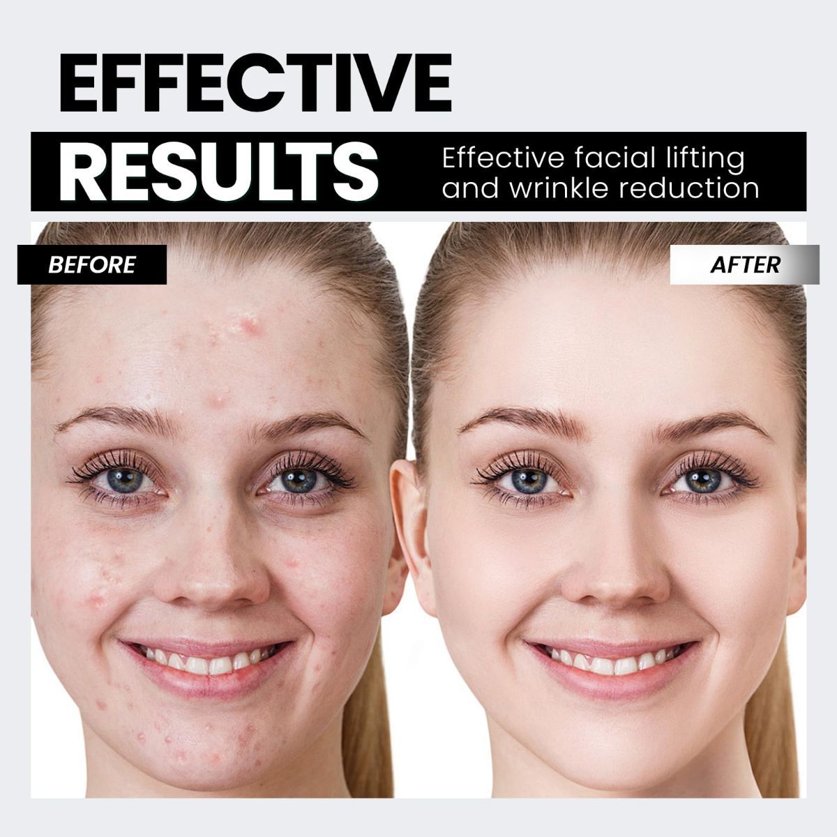 Microcurrent Facial Device,Latest Red Light Technology，Enhances The Ability to Lift The Face and Tighten The Skin，Facial Wrinkle Equipment，Smart Photon Micro-Current Device - White - Size 15cm