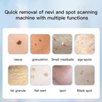 Dotting Mole Pen Nevus Removal Tool Spot Remover Red Blue Light Therapy Beauty