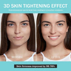 Upgraded Version | Skin Care Device - Facial Glow Booster for Maximizing and Boosting Absorption - Needle Free, Radiance, Elasticity | LED Anti-Wrinkle Device | Skin Care Firming, Toning