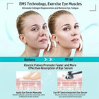 Eye Beauty Device Eye Care Anti-Aging Dark Circles Puffiness Fine Lines