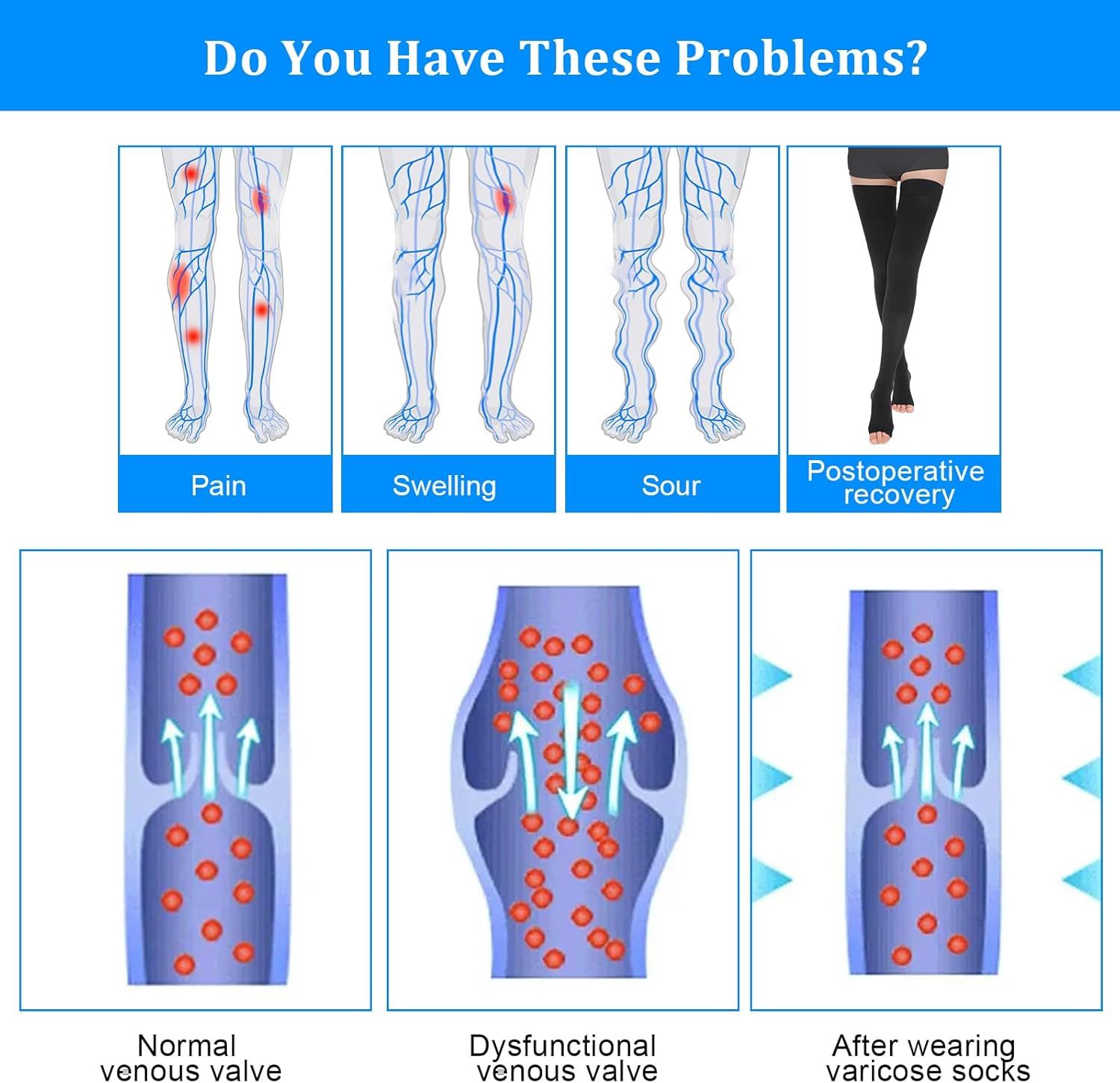 Thigh High Compression Socks for Women Men 23-32 mmHg Open Toe, Level 2 Support for Varicose Veins Edema, Breathable Cotton Spandex with Silicone Dotted Bands