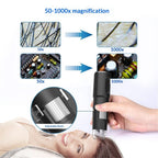 Wireless Skin Analyzer Machine Dermatoscope Scalp/Skin/Hair follicle Detection Testing Analysis Magnifier UV Skin Analyzer Professional 1000X Facial Skin Detector Digital Microscope