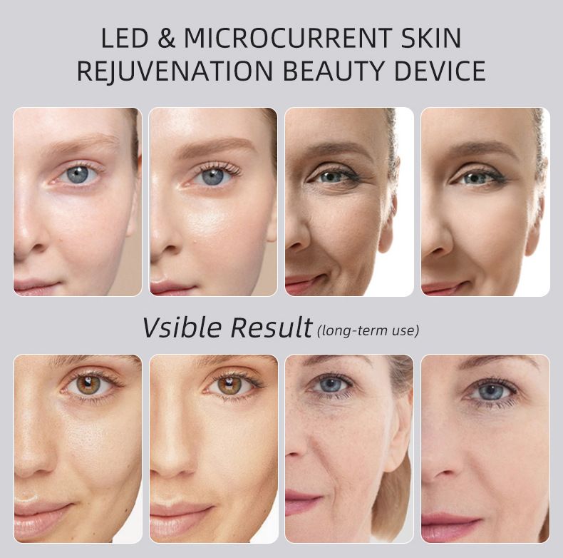 Beauty Device: Red and Blue Light, Home Use, Portable, Vibrating, Multi-Functional, with Voice Guidance, 5-Color Light Therapy, Eye Massage, Eye Care Device/"Upgrade" pink beauty introducer
