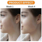 Jaw Exerciser, Jawline Exerciser, Jaw Exerciser for Women Men, Jaw Excersizer for Chisell and Define Your Jawline