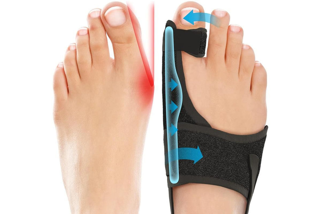 1 Pair Bunion Corrector Adjustable Length Orthopedic Toe Separator for Men and Women