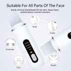 Rechargeable Ultrasonic Facial Spatula - Deep Pore Cleanser & Exfoliator